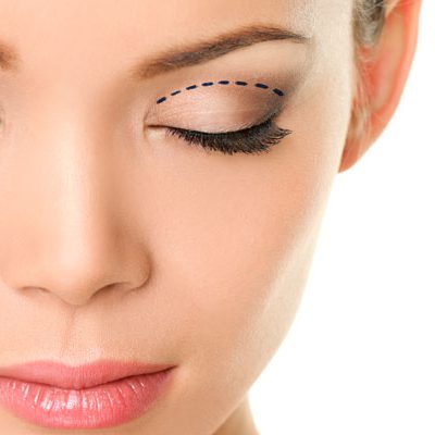 Blefaroplastyka Warszawa: plastyka powiek górnych i dolnych