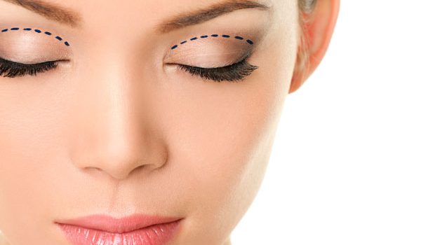 Plastyka powiek górnych i&nbsp;dolnych: wizualizacja