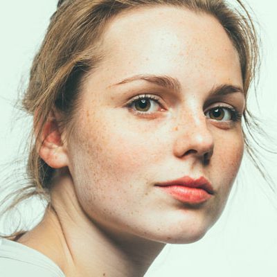 3 najbardziej skuteczne metody usuwania przebarwień skóry