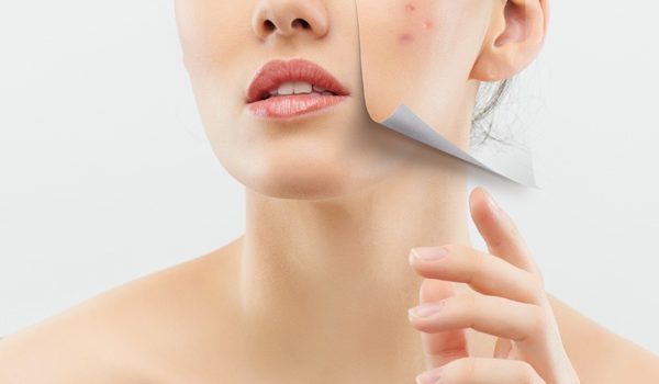 Diagnostyka i&nbsp;leczenie trądziku