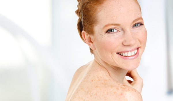 Czerniak skóry i znamiona barwnikowe