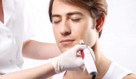 Mikronakłowanie skóry twarzy