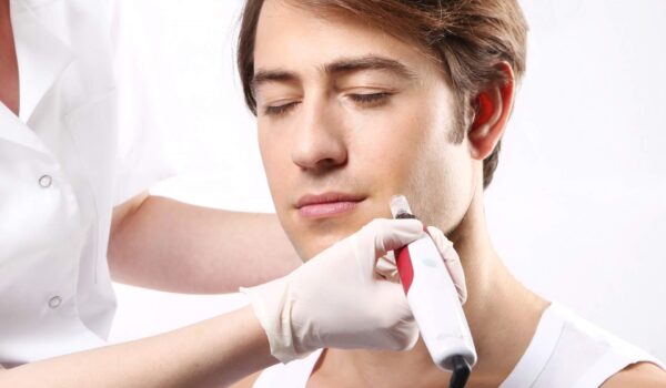 Pacjent podczas zabiegu z&nbsp;użyciem Dermapenu